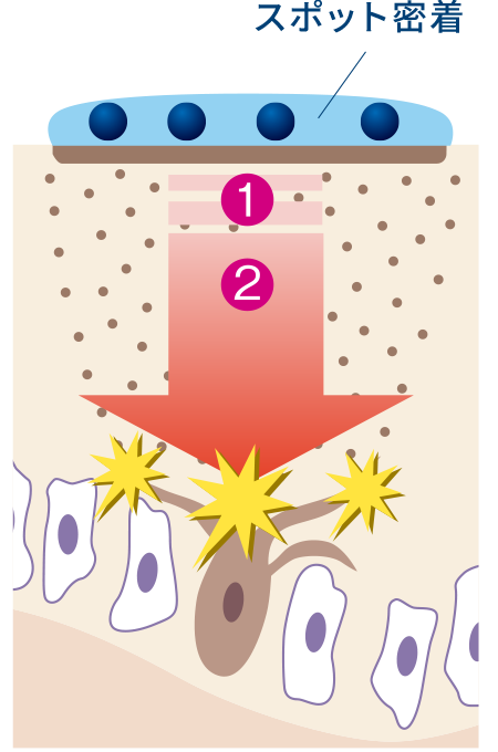 4つの有効成分でシミの発生を抑えることができる